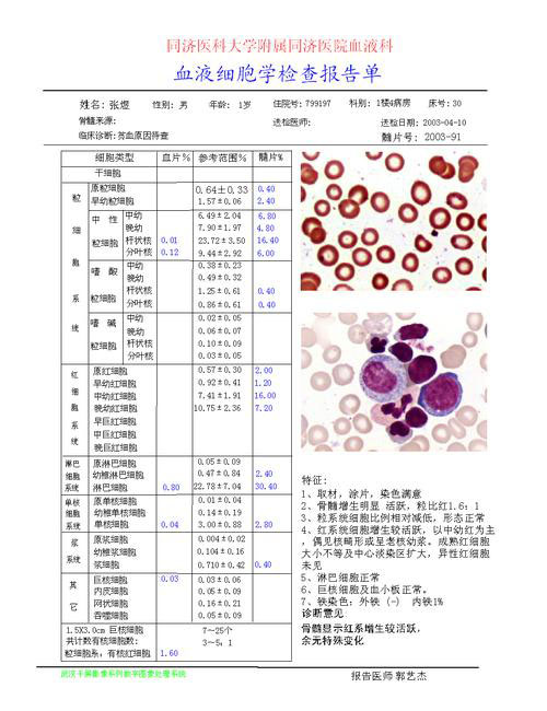 报告单