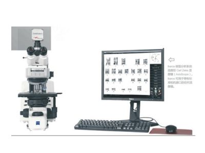 染色体核型分析系统