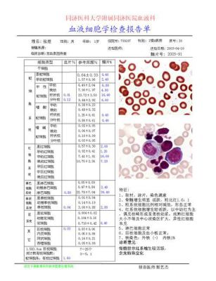报告单