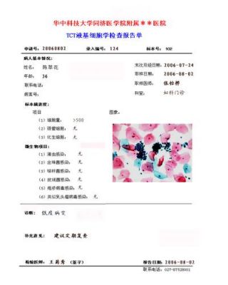 TCT报告单